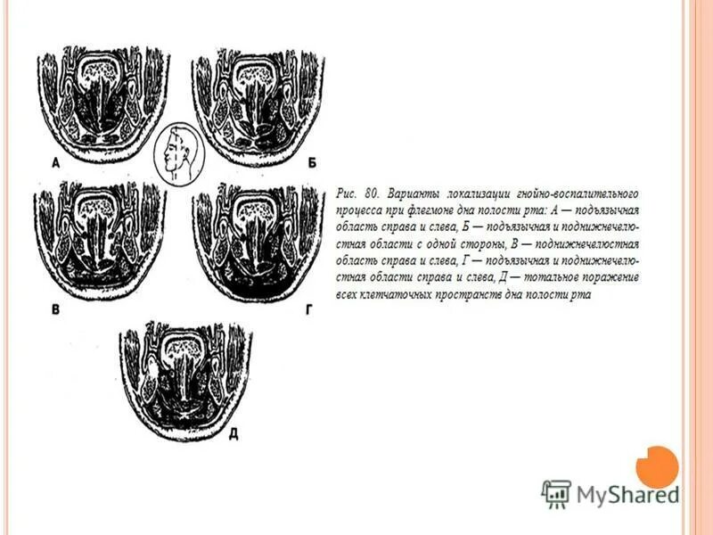 Пространства дна полости рта