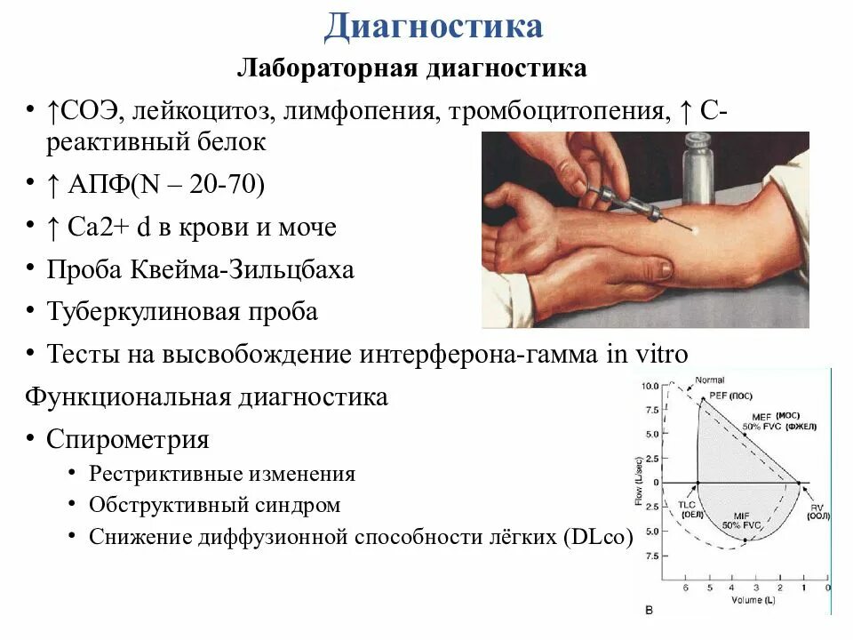 Лейкоцитоз тромбоцитопения. Проба Квейма Зильцбаха. Положительная реакция Квейма. Проба Квейма на саркоидоз.