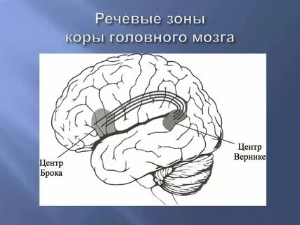 Зона брока и вернике за что отвечает