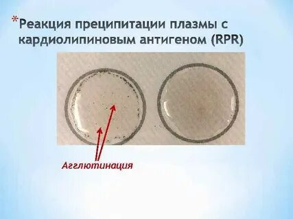 Кардиолипиновая проба что это за анализ