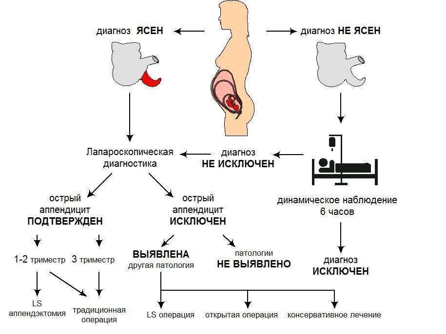 Аппендицит у беременных симптомы. Аппендицит у беременных симптомы 2 триместр. симптомы аппендицита у женщин при беременности 2 триместр. аппендицит при беременности 1 триместр симптомы. аппендицит при беременности 3 триместр.