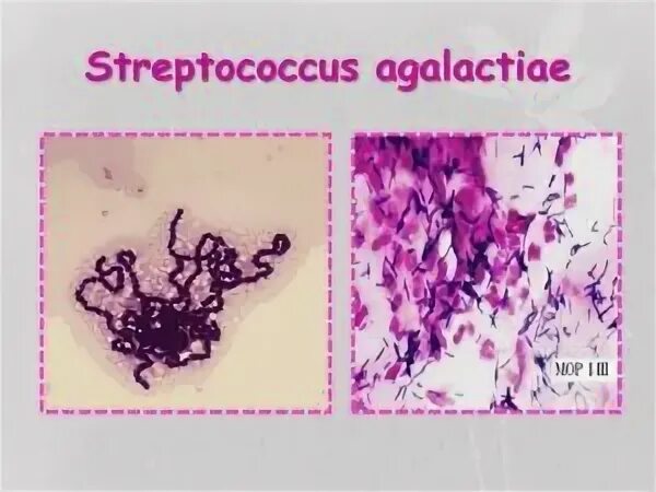 Streptococcus в мазке у мужчин. Streptococcus agalactiae микроскопия. Стрептококк агалактия скарлатины. Стрептококк агалактия в мазке.