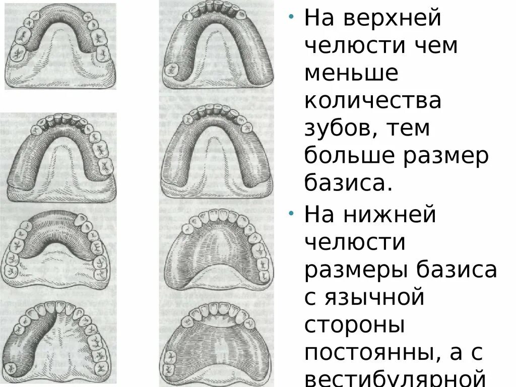 Длина базиса. Ширина верхней челюсти. Длина базиса верхней челюсти. Толщина базиса верхней челюсти.