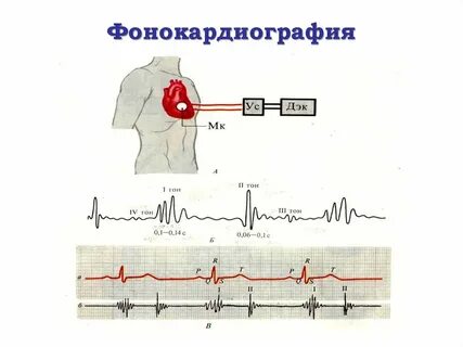 Электрокардиография один из важных