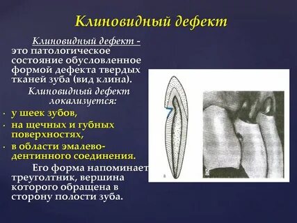Клинический дефект