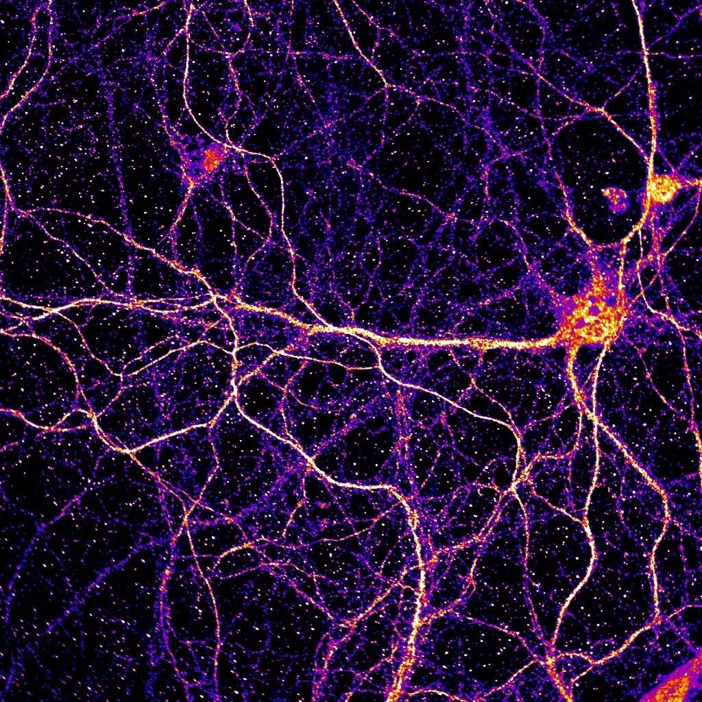 Клетки головного мозга. Нейронная клетка. Нейроны мозга. Нейронные связи в мозге.
