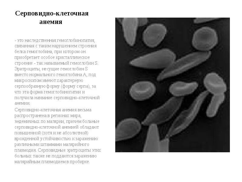 Изучение формы эритроцитов человека серповидной клеточной анемии. Серповидноклеточная анемия (гемоглобинопатия). электрофорез при серповидноклеточной анемии. строение гемоглобина при серповидноклеточной анемии. структура гемоглобина при серповидноклеточной анемии.