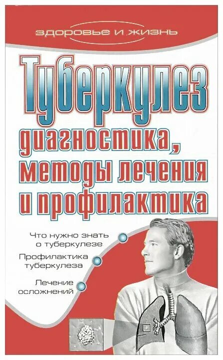 Туберкулез книга. Книги по туберкулезу. Туберкулез справочник. Книжки про туберкулез. Книжки про туберкулез книжки.