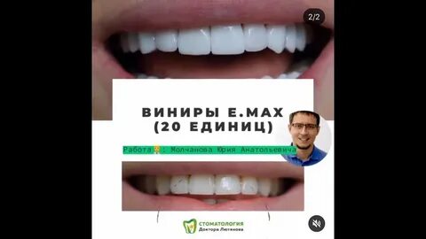 Зубы в иркутске
