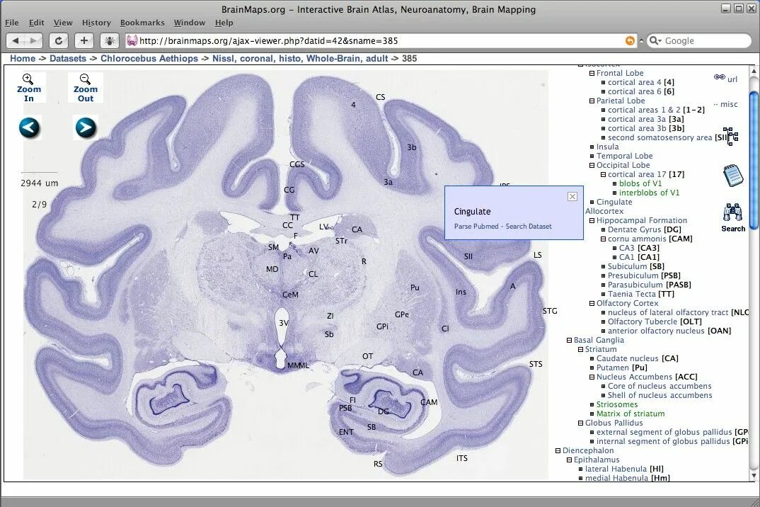 Атлас мозга мыши. Стереотаксический атлас мозга. Brain карта
