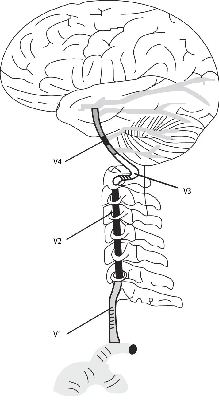 Позвоночные артерии v1-v3. Сегмент v2 позвоночной артерии. Сегменты v1 v2 позвоночных артерий. Сегмент v1 позвоночной артерии.