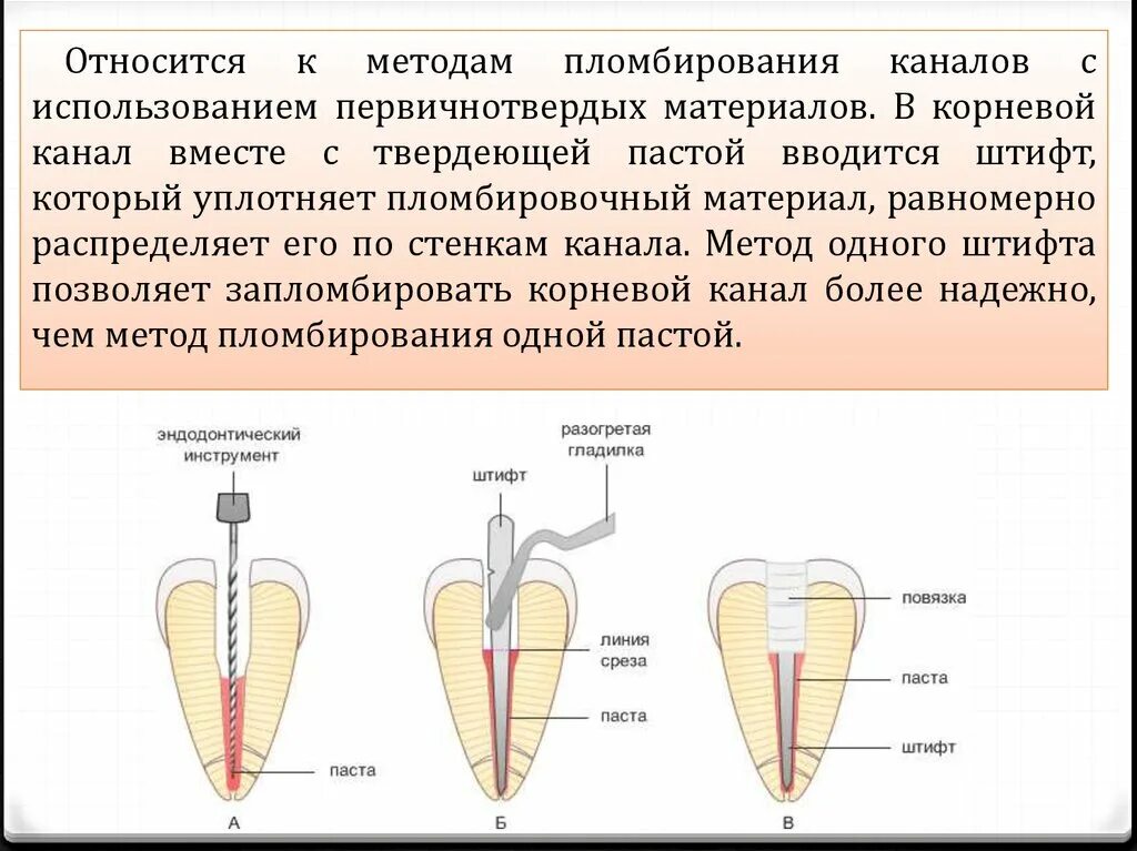 1. Методы пломбирования корневых каналов.. Методика пломбирования корневого канала пастами. Пломбирование корневого канала, задачи, методики. Пломбировка каналов пастой методика. Пломбировка корневых каналов