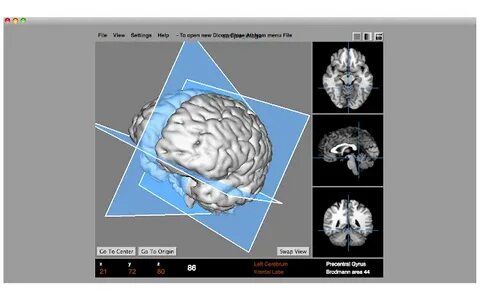 DICOM Viewer Cloud Model Access: ALM Medical