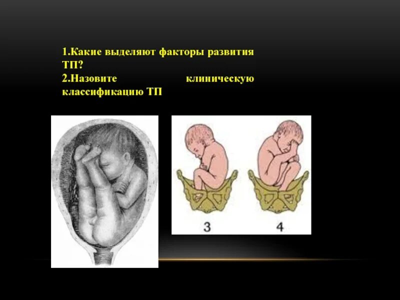 Какое должно быть предлежание. Предлежание плода. головное предлежание плода. головное предлежание плода на 32 неделе.