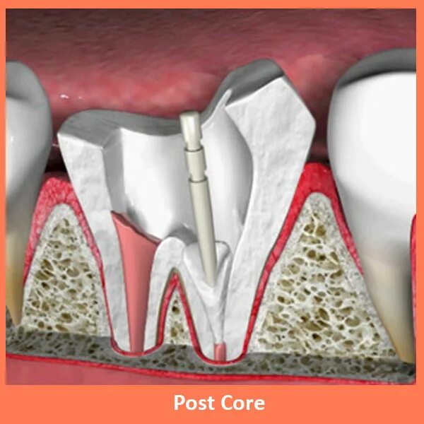 Core posting. Core posting