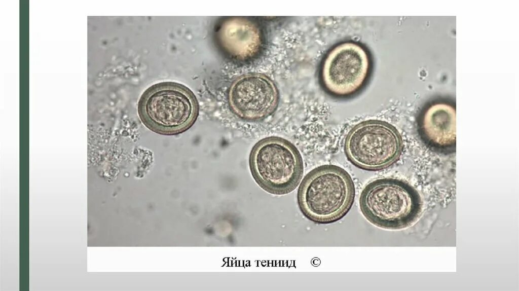 Цисты в воде. Яйца гельминтов микроскопия. микроскопия кала яйца гельминтов. цисты лямблии микроскопия. цисты лямблий микроскопия кала.