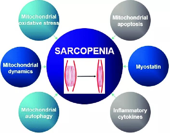 Саркопения это простыми словами. Саркопения. Саркопения патогенез. Саркопения слайды. Эстрогены и саркопения.