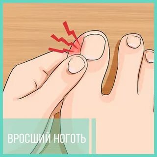 Болит кожа большого пальца