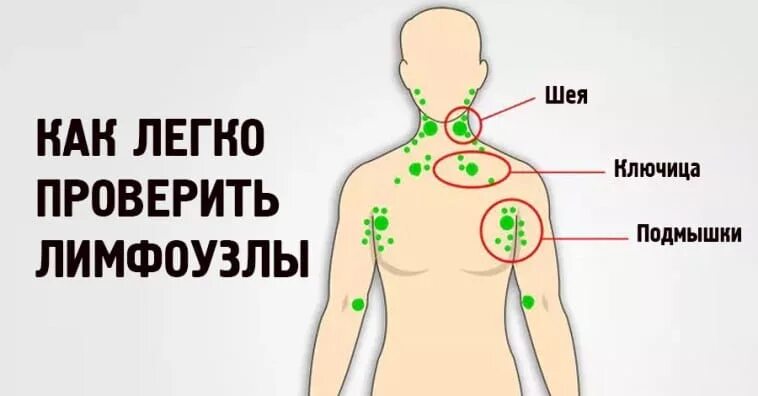Лимфоузлы на груди у мужчин. Подмышечные лимфатические узлы расположение. Строение молочной железы лимфоузлы. Где находится лимфоузел под. Лимфатические узлы на теле человека схема у мужчин.