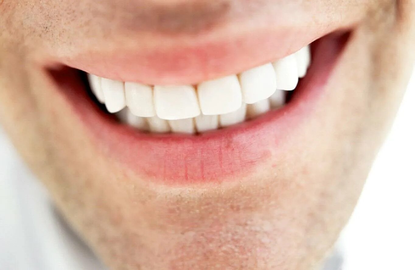 Белые зубы признак. Красивые зубы. Красивые ровные зубы. Красивые ровные зубы. Красивые зубы.