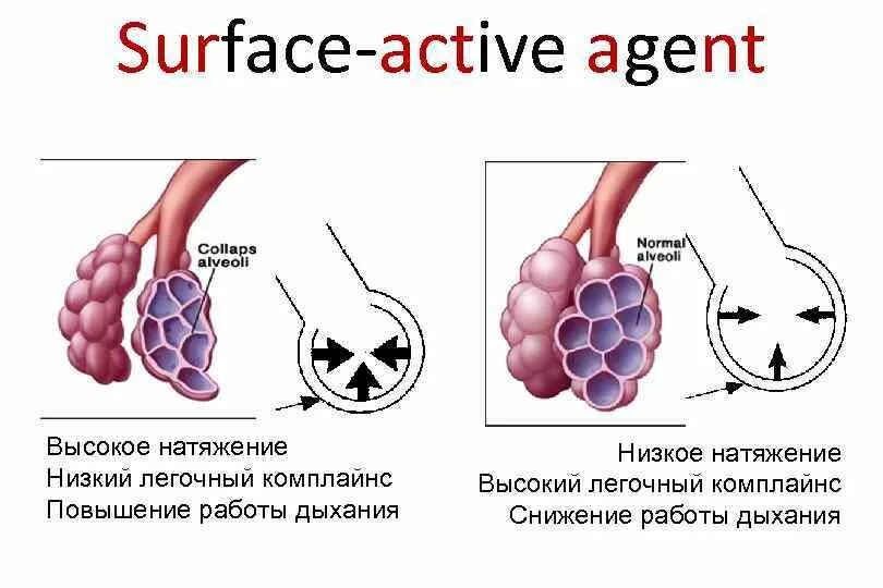 Art fact soft surfactant complex. Легочный комплайнс. легочный комплайнс оценка результата. комплайнс повышен. surfactant lung.