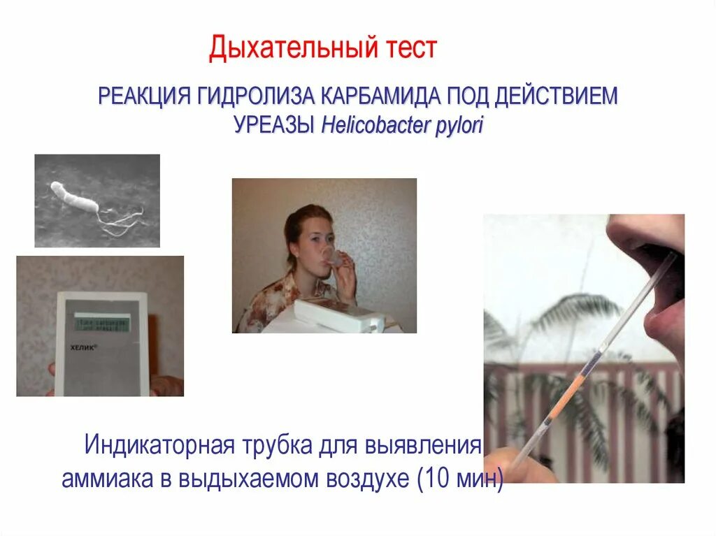 Урезанный дыхательный тест. 13с-уреазный дыхательный тест заключение. С13 дыхательный тест на хеликобактер. Дыхательный тест для определения h.pylori;. Дыхательный уреазный тест с мочевиной с13.