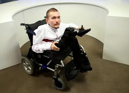 Мужчина пересадка головы