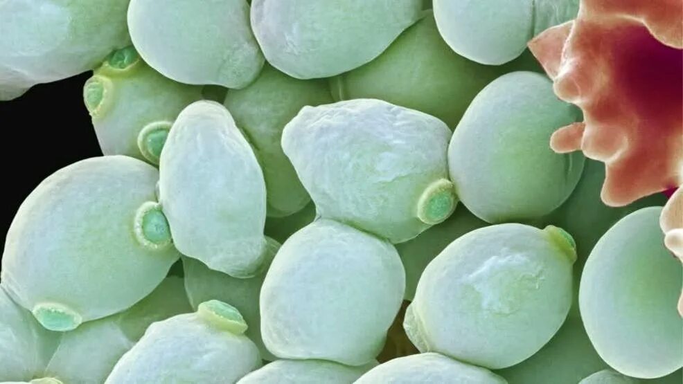 Дрожжеподобный гриб candida albicans. Грибы кандида микроскопия мазка. Псевдомицелий микроскопия. Грибок кандида под микроскопом. Гриб candida у женщин.