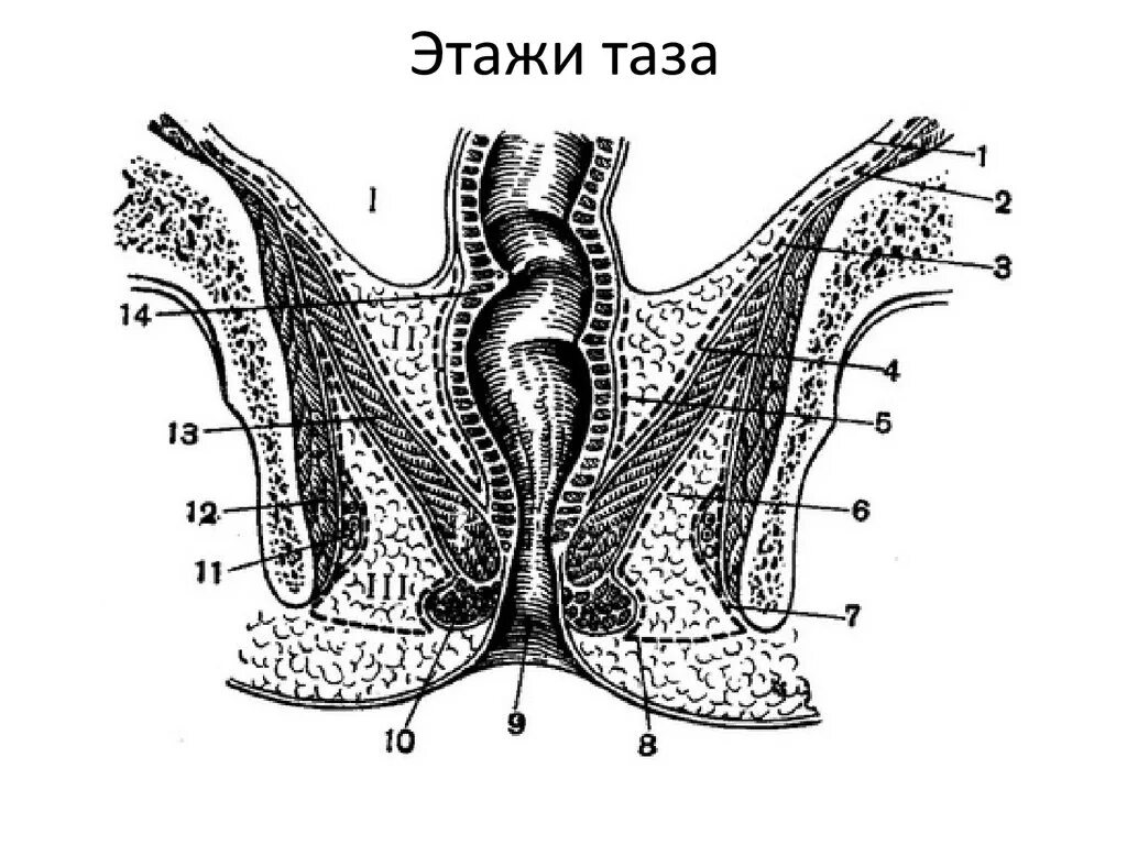 Таза абдоминально. Этажи малого таза топография. этажи малого таза топографическая анатомия границы. деление полости малого таза на этажи. топография малого таза схема.