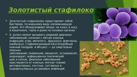 Стафилококк у женщин причины
