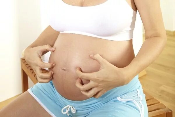 Зуд после беременности. Сыпь на животе у беременных. Беременные начальная стадия.