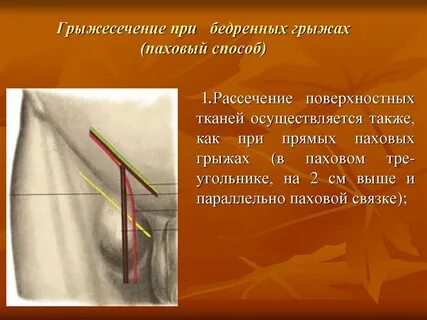 Грыжи грыжесечения