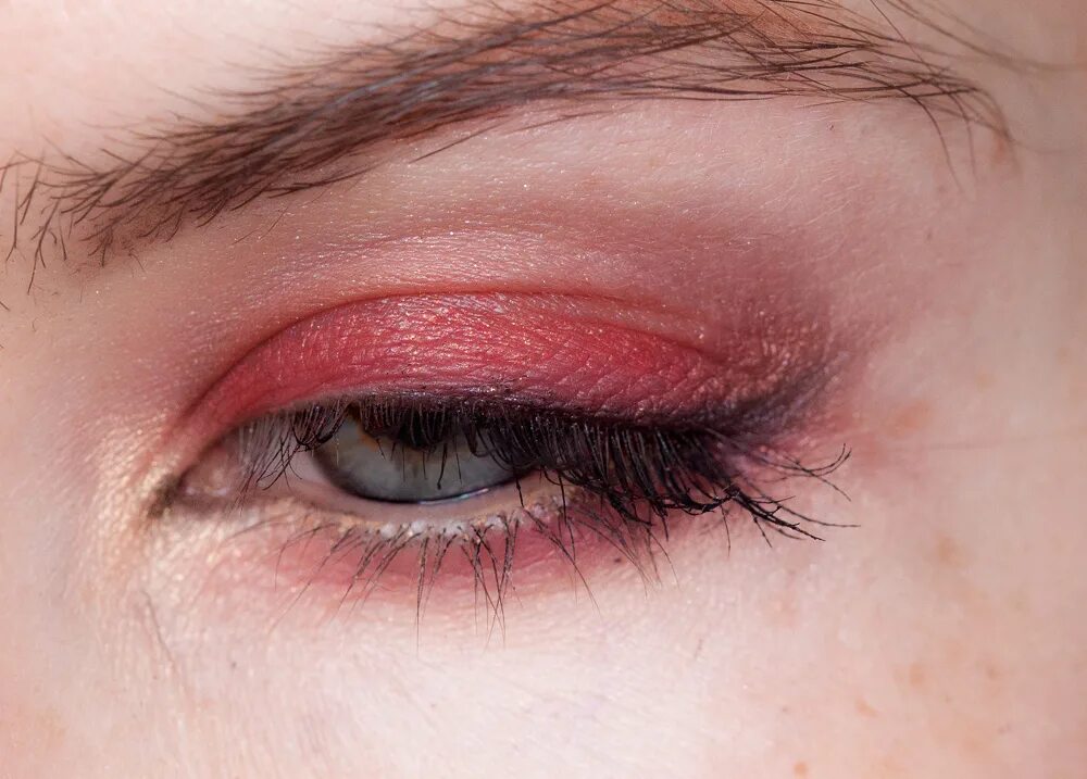 блефарит (воспаление края век). демодекозный блефарит. блефарит конъюнктивит ячмень. покраснение нижнего века. макияж с подводкой нижнего века.