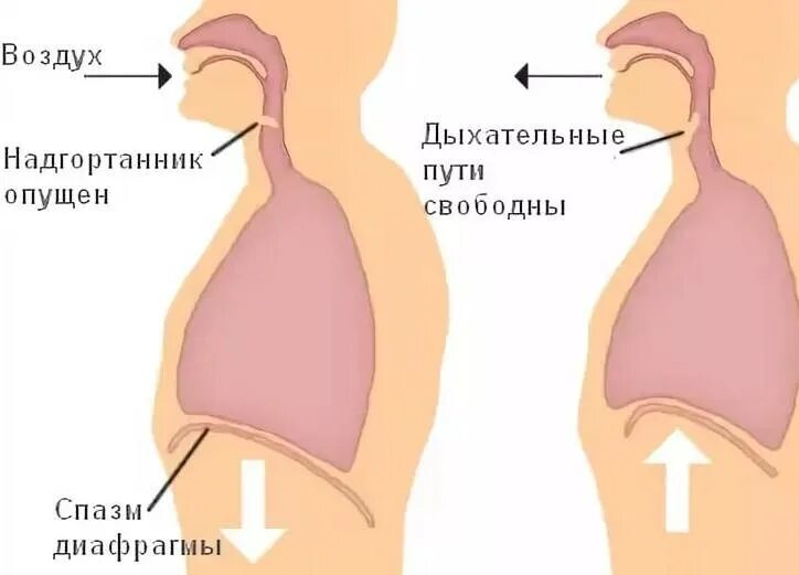 Диафрагма икота. Спазм диафрагмы. Икота причины. Почему человек икает. Как остановить икоту у ребенка