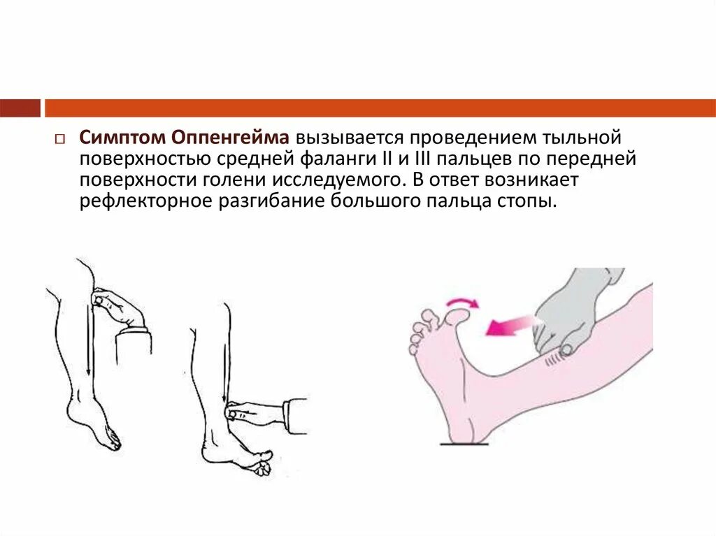 Бабинского и Оппенгейма. Рефлексы Бабинского, Оппенгейма, Россолимо. Симптом Бабинского и Оппенгейма. Рефлексы (Оппенгейма, Шеффера, Бабинского, Россолимо, Гордона.