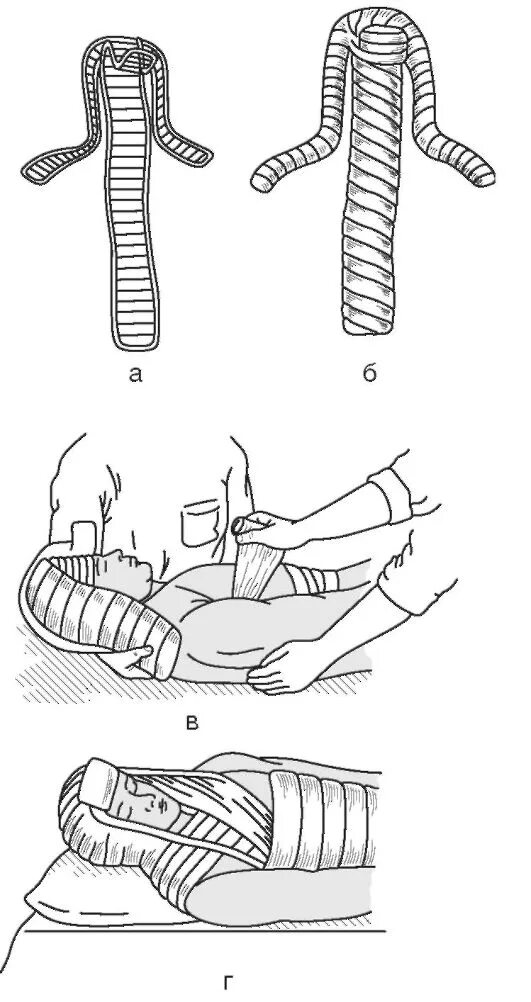 Шина при травме головы. Транспортная иммобилизация шиной Башмакова. Перелом позвоночника транспортная иммобилизация. Шина Крамера при переломе позвоночника. Транспортная иммобилизация при переломе шейного отдела позвоночника.