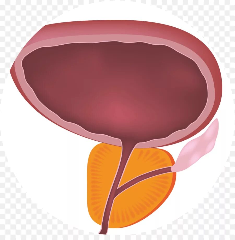 Простатит у человека. Гиперплазия предстательной железы. Предстательная железа анатомия. Простата рисунок. Мочевой пузырь и предстательная железа.
