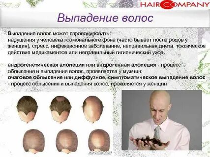 Алопеция клинические рекомендации