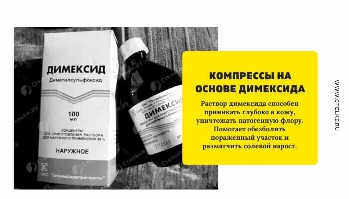 Компресс от пяточной шпоры. Лекарство для компрессов димексид. примочки с димексидом. мазь от пяточной шпоры димексидом.