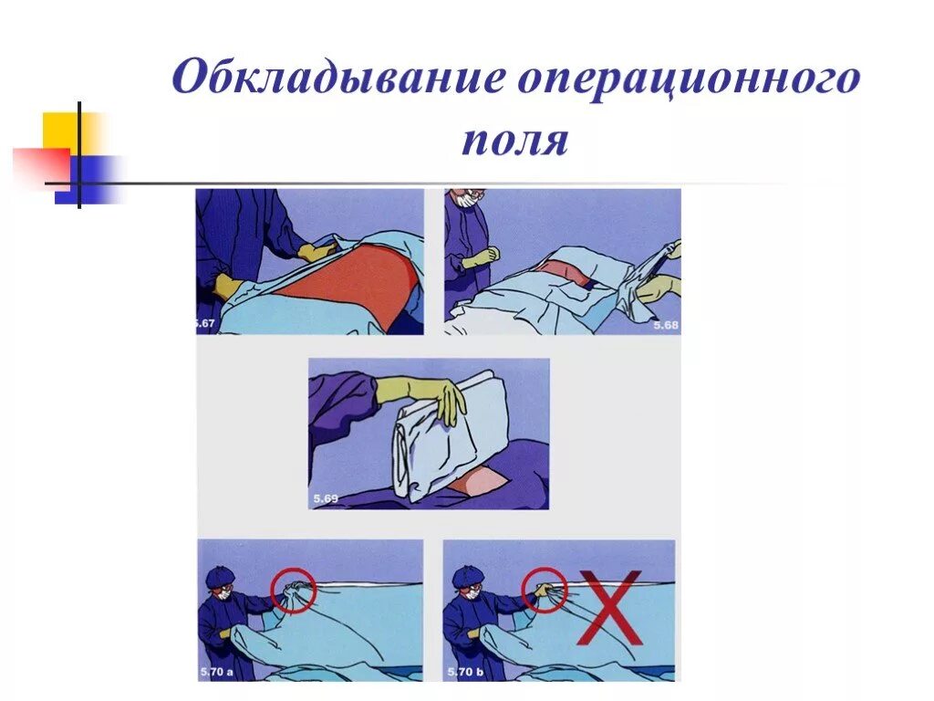 Алгоритм операционного поля. Обкладывание операционного поля. Обработка операционного поля. Этапы подготовки операционного поля. Методы обработки операционного поля.