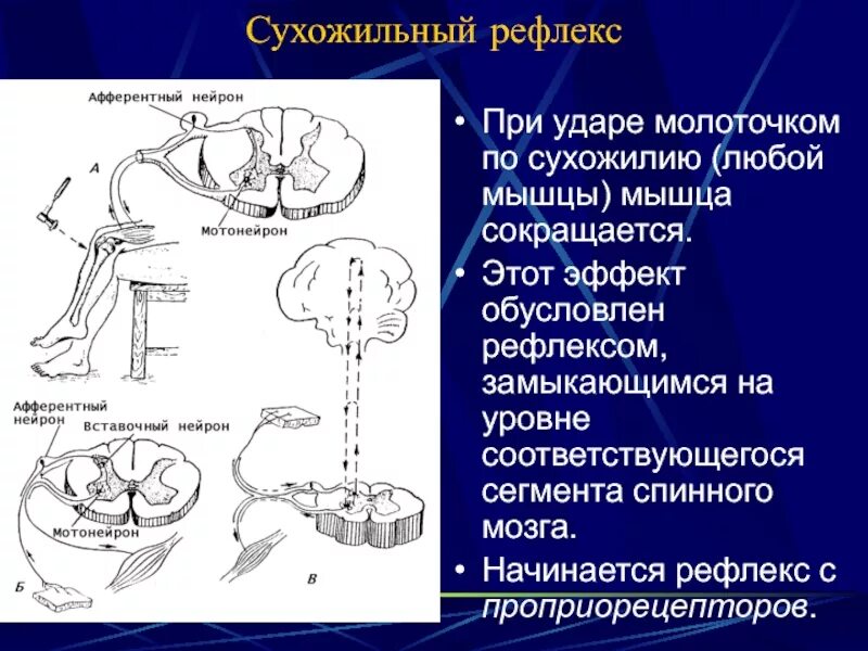 Сухожильные рефлексы. Сухожильные рефлексы рефлексов. Сухожильные рефлексы у детей. Сухожильные рефлексы физиология.