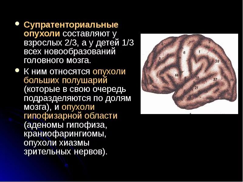 Супратенториальные структуры что это. Супратенториальные опухоли головного мозга. супратенториальные структуры. супратенториальные структуры в головном мозге что это.