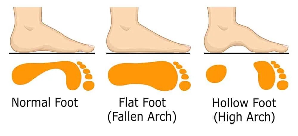 Normal feet