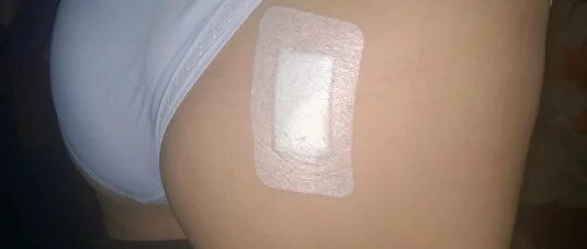 Абсцедирующий фурункул: медицинские фотографии Вдали от цивилизации Фотогалерея 