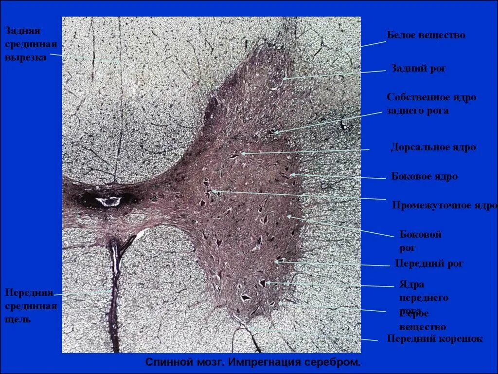 Поперечный разрез спинного мозга импрегнация азотнокислым серебром. Спинной мозг импрегнация серебром препарат. Поперечный срез спинного мозга гистология препарат. Микропрепарат «спинной мозг», импрегнация серебром.