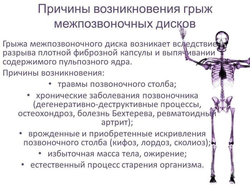 Можно ли вылечить грыжи шейные