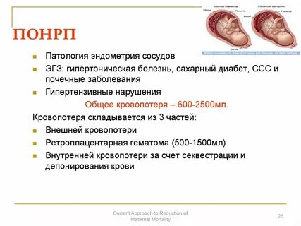 Отслойка плаценты последствия