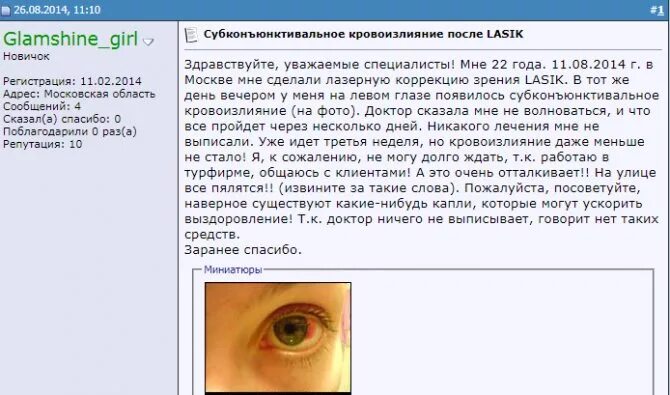 Гемофтальм мкб 10. Субконъюнктивальное кровоизлияние. Суб коньюнктивальное кровоизлияние. Субконъюнктивальное кровоизлияние в глазу. Субконъюнктивальное кровоизлияние код мкб.