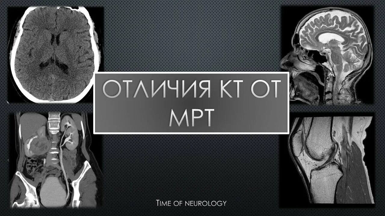 Чем отличается узи от мрт. Кт и мрт различия. Отличие кт от мрт. Разница между кт и мрт. Компьютерная томография и мрт в чем разница.