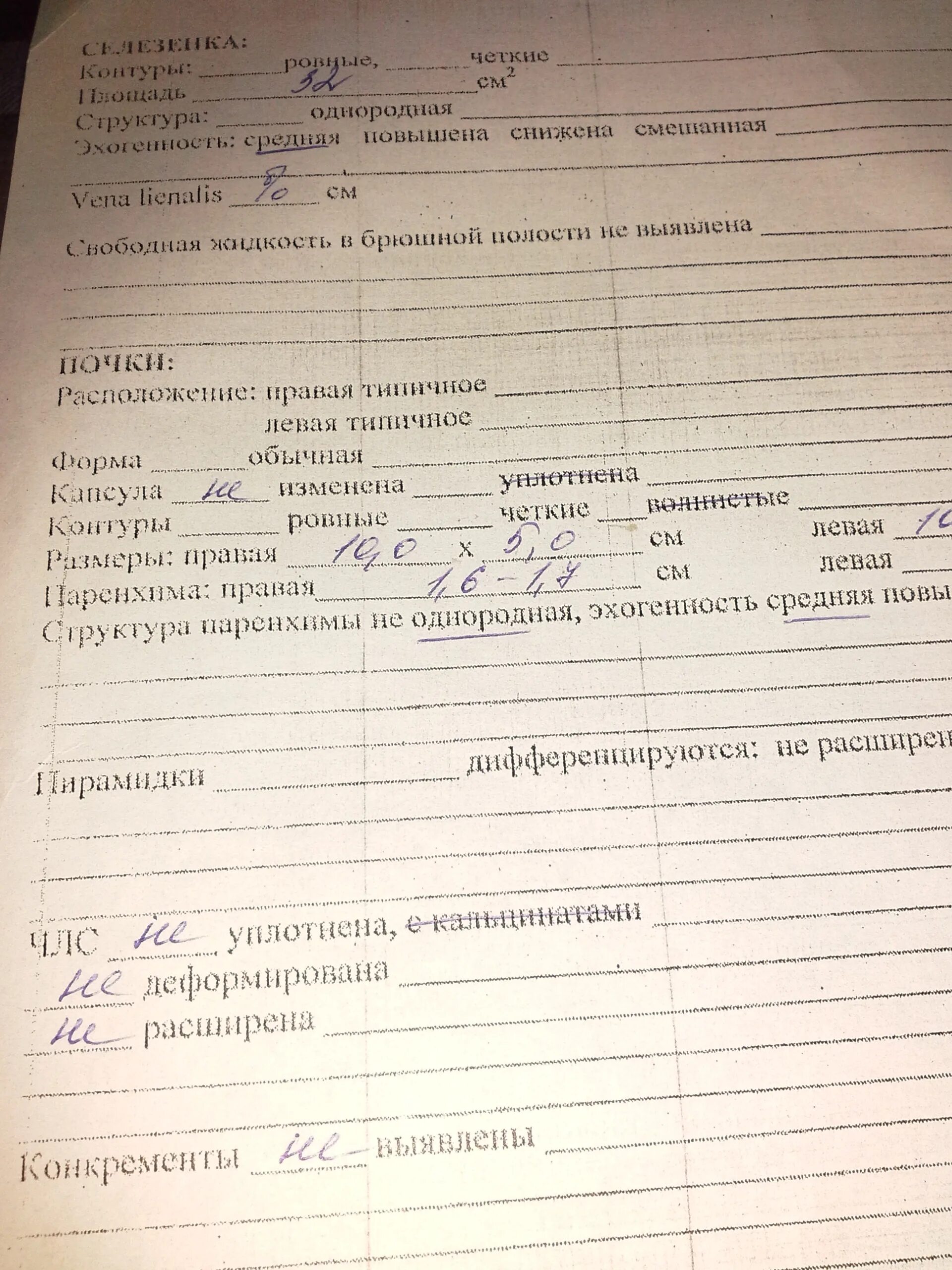 Генетический тест на жильбера. Синдром Жильбера генетика. Анализ Жильбера. Синдром Жильбера анализ. Результат анализа на Жильбера.